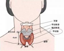 甲状腺结节的相关问题?