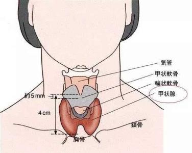 重庆哪家医院治甲状腺结节好