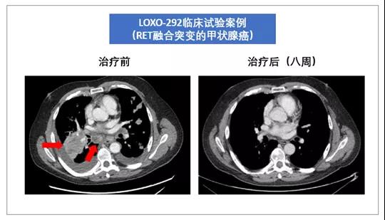 重庆治疗甲状腺医院哪家好